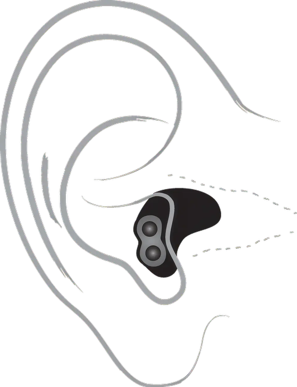 Technical drawing of an in-ear listening device with two speakers and slender wires.